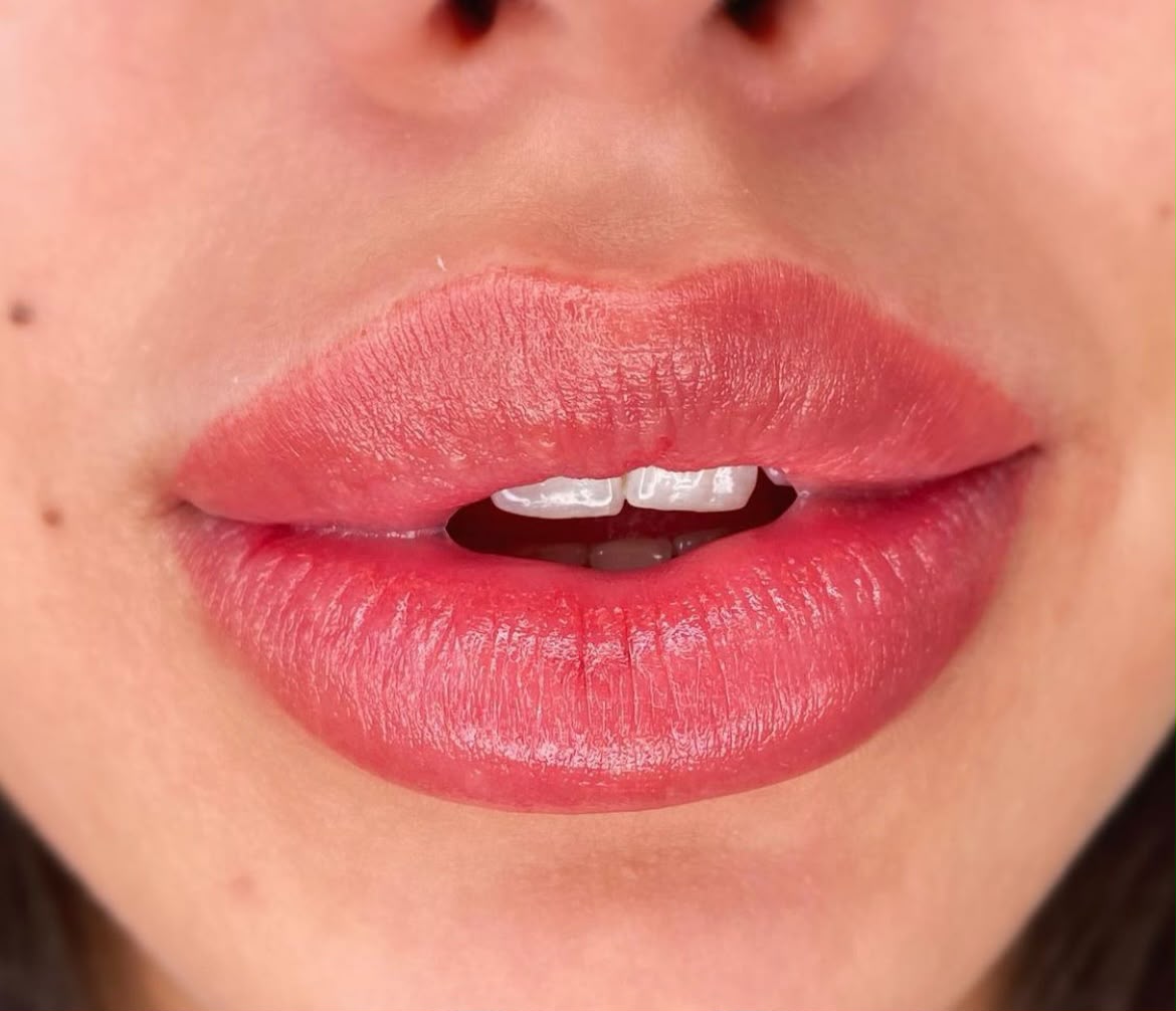 Ergebnis Lippenpigmentierung bei GOLDSKIN